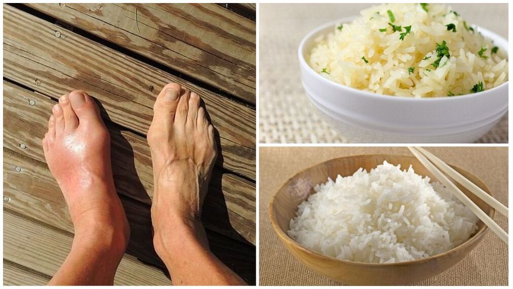 При пациенти с подагра се препоръчва диета на основата на ориз. 